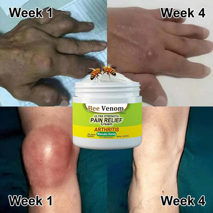 ORIGINAL™ BEE VENOM JOINT AND BONE THERAPY CREAM 25000+ HAPPY CUSTOMER